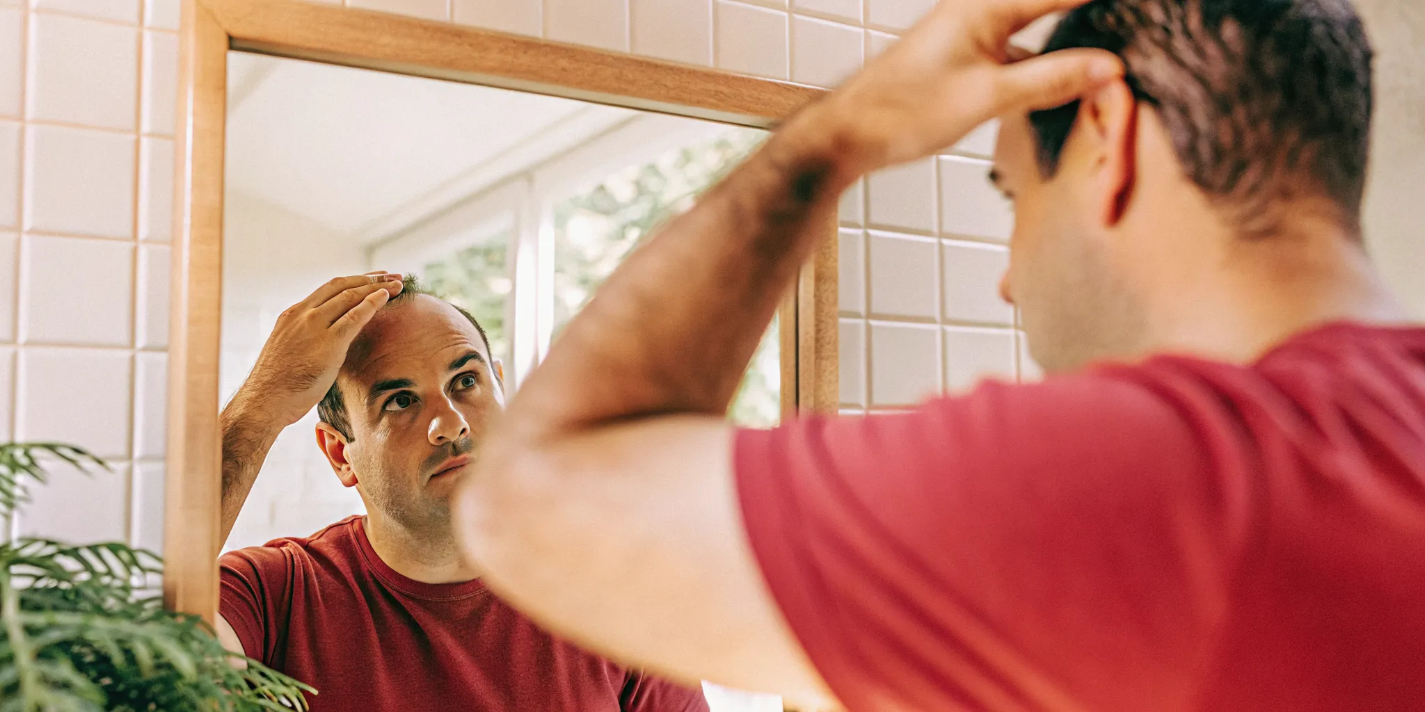 Man examining his hairline in a mirror six months after a hair transplant showing visible new growth