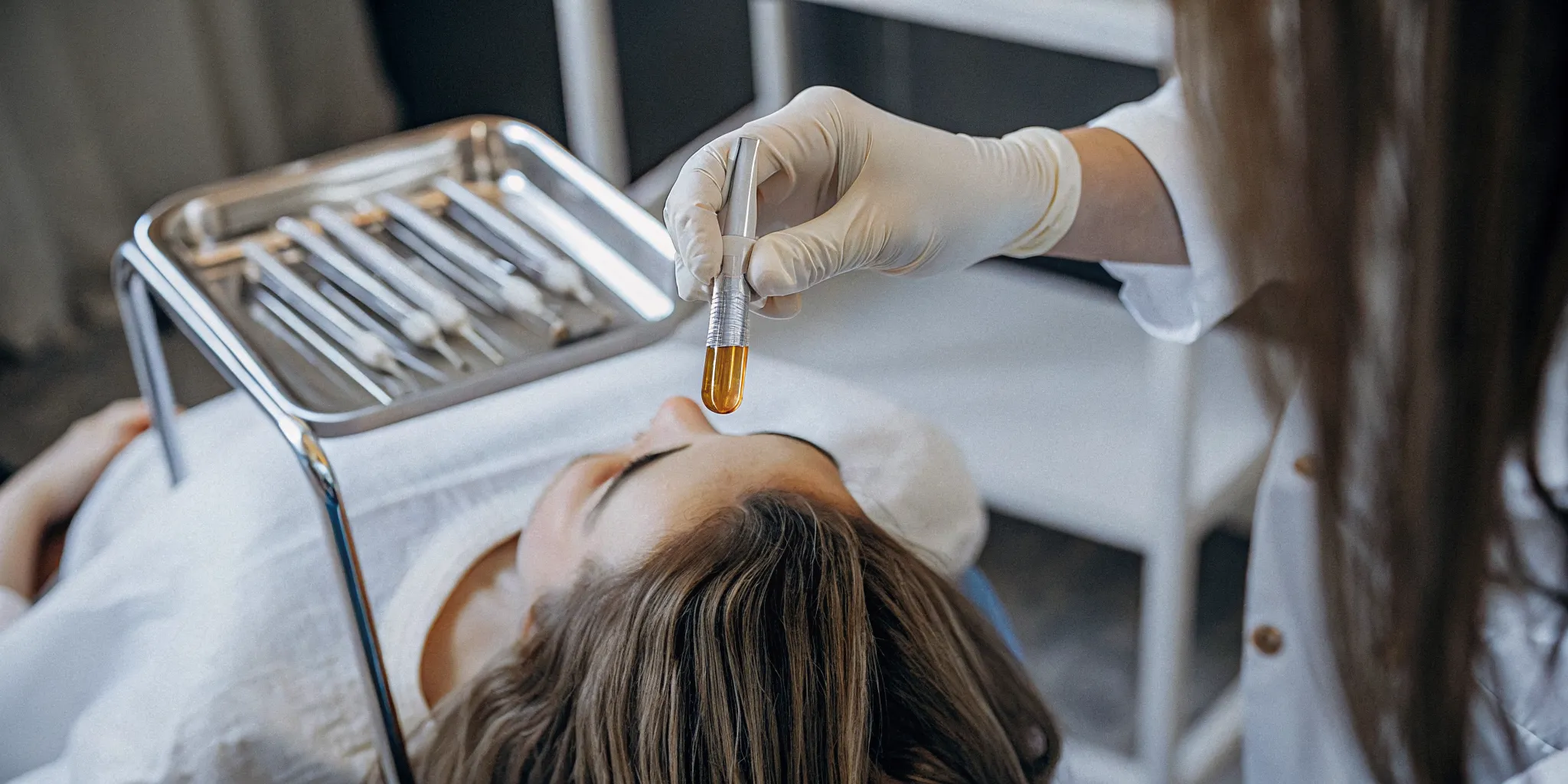 Platelet rich plasma prepared for PRP hair restoration treatment