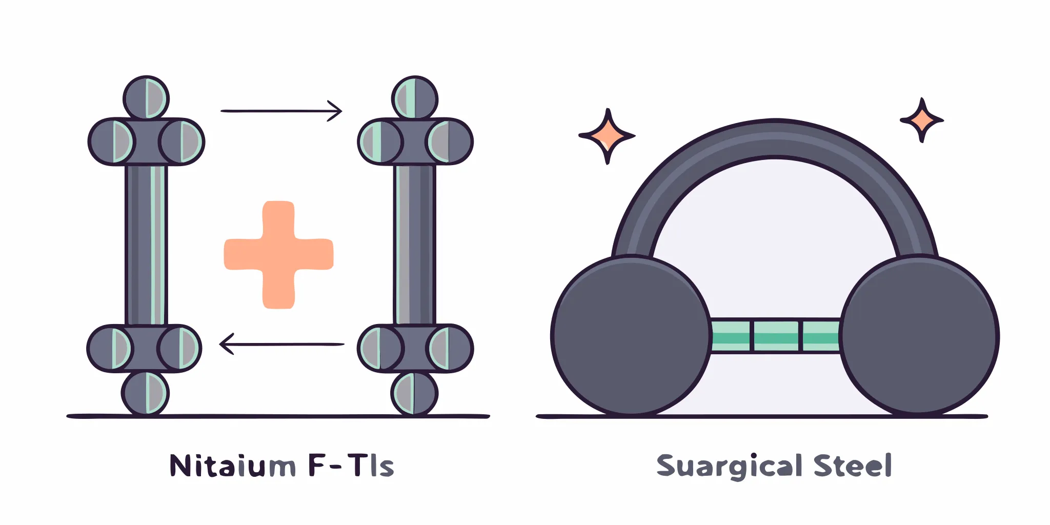 Flat vector illustration comparing implant-grade titanium and surgical steel, highlighting the nickel content difference