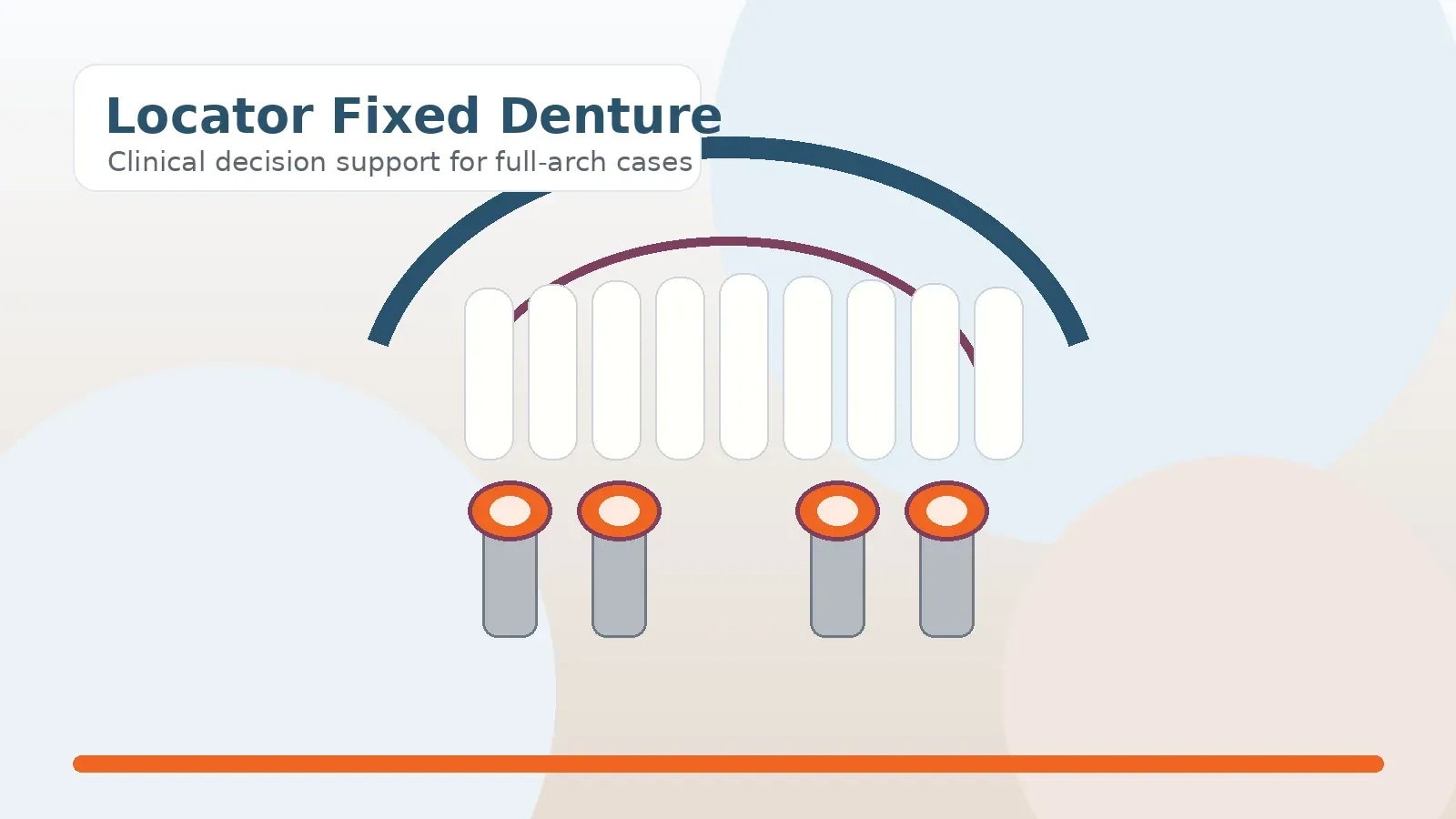 Locator fixed denture full-arch implant treatment planning illustration
