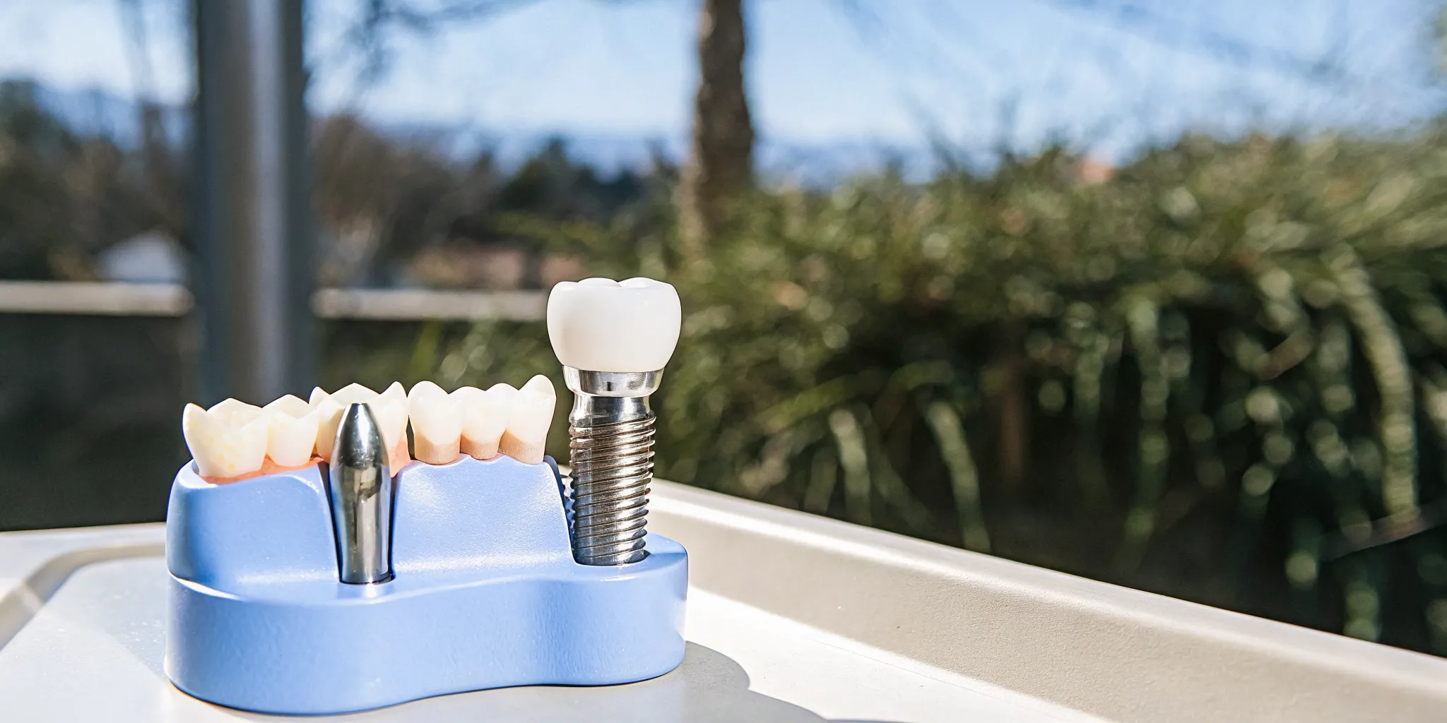 A clean set of traditional dentures sitting next to a modern dental implant on a professional dental tray.