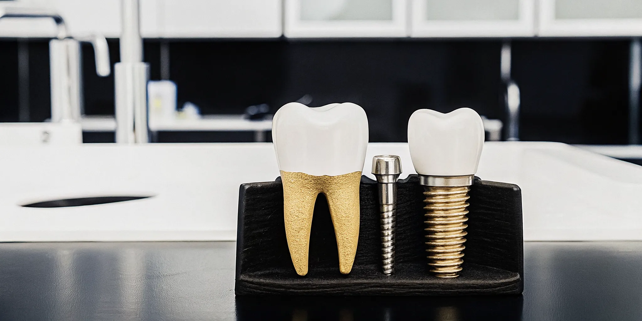 Dental implant post and tooth model illustrating the dental implant process