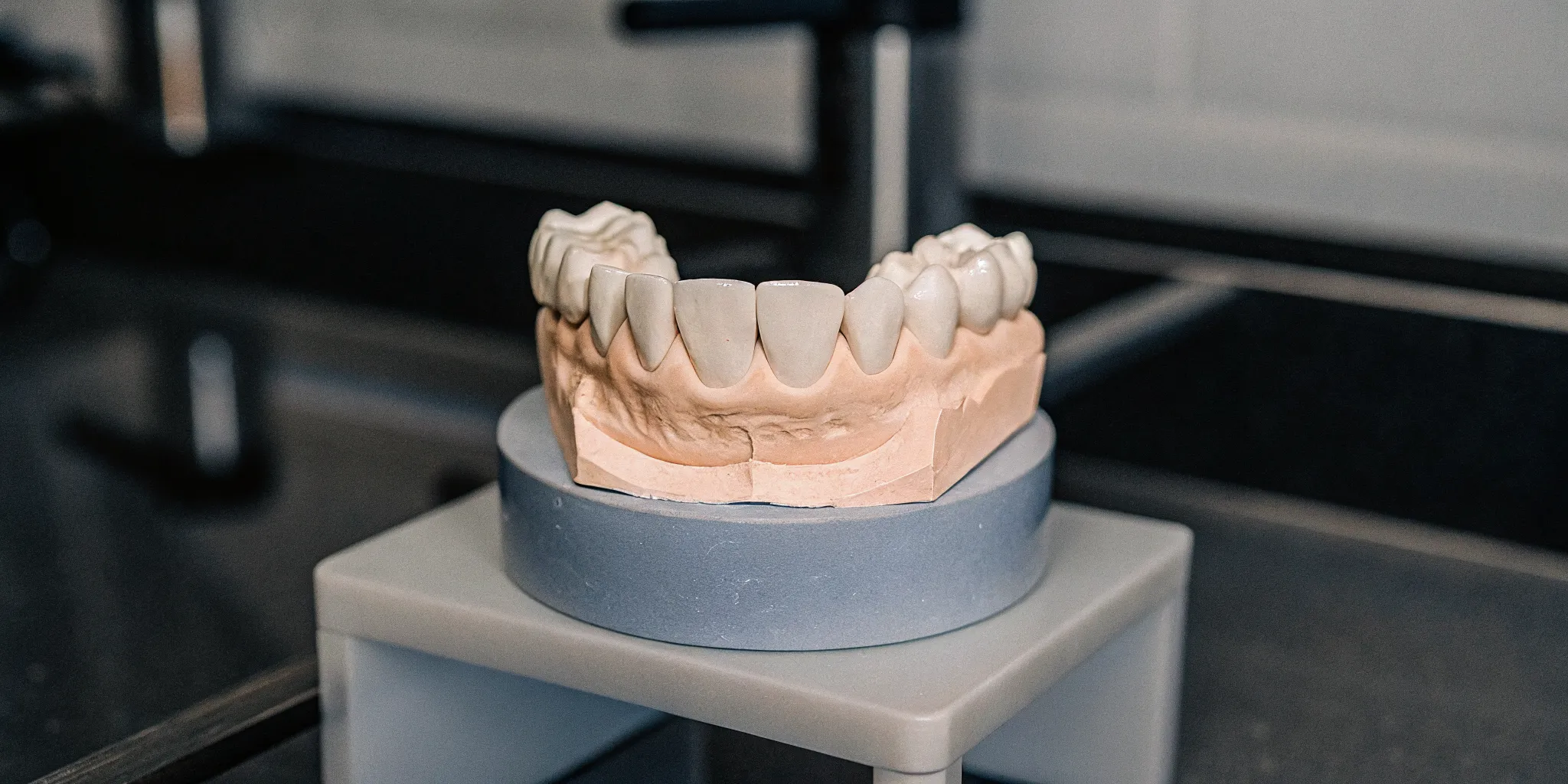 A modern high-quality ceramic dental crown