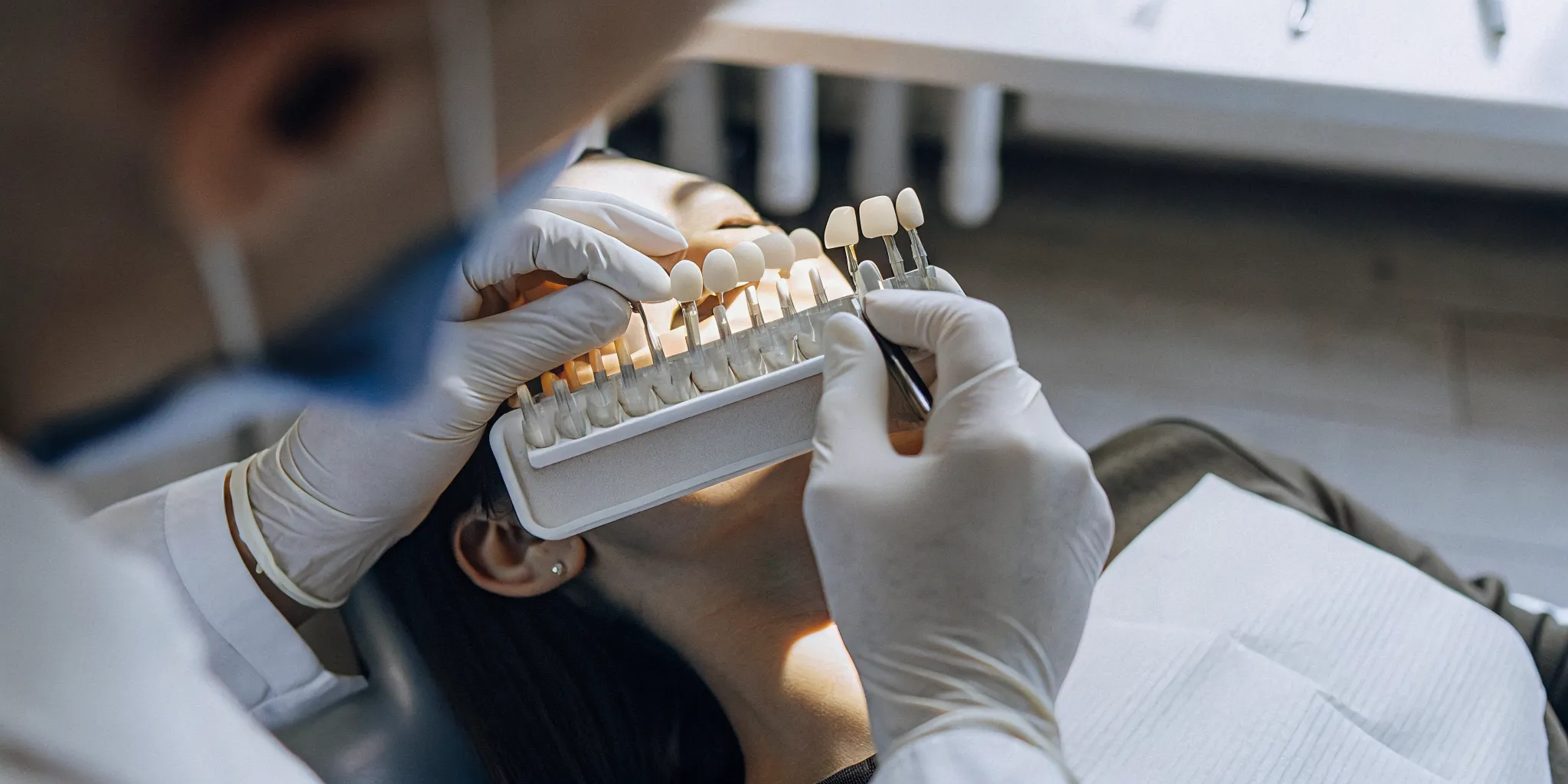 A dentist placing thin porcelain veneers on a patient's teeth in a modern dental office