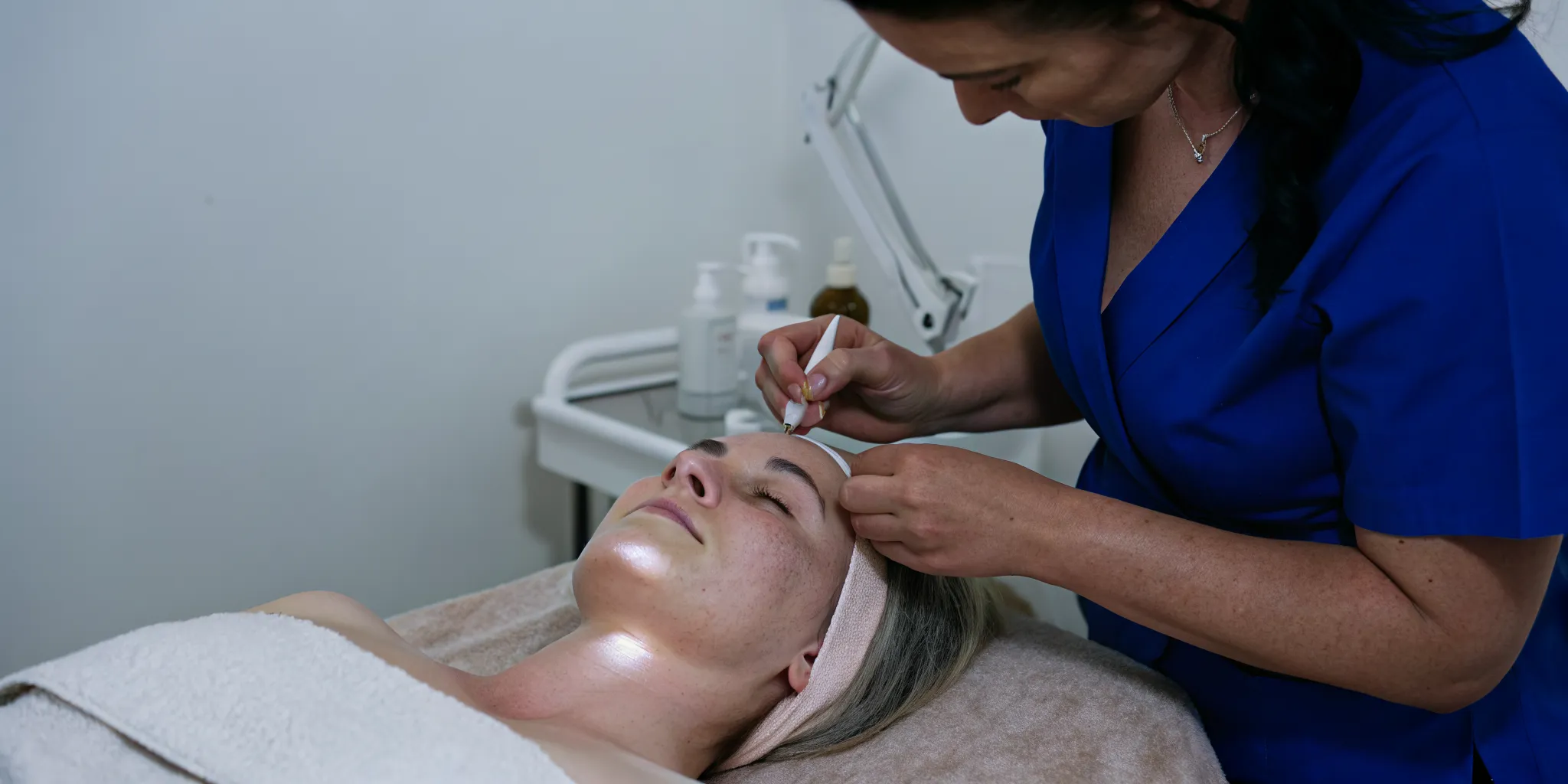 Gentle products for microneedling aftercare for acne-prone skin