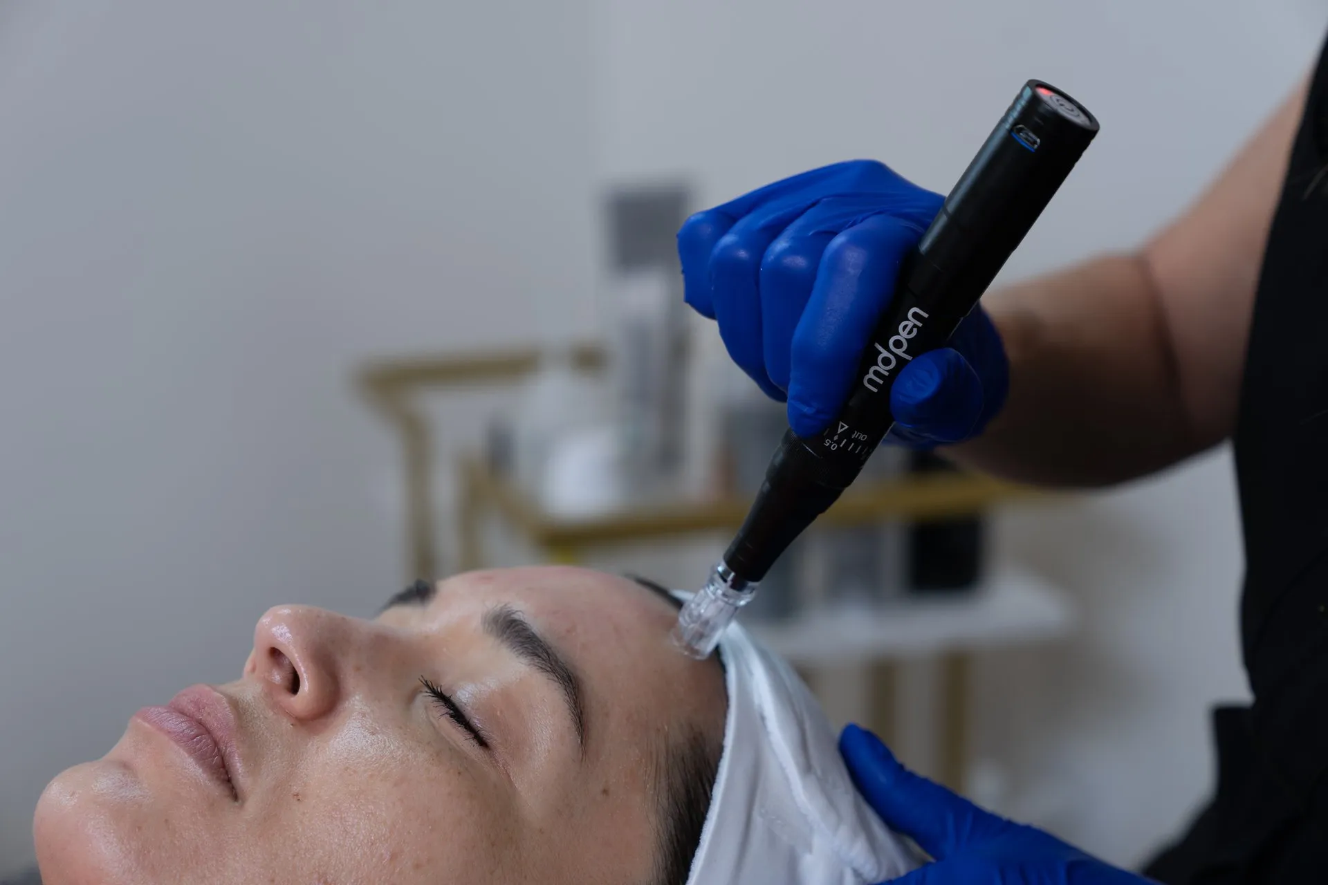 MDPen microneedling device used during a practitioner consultation