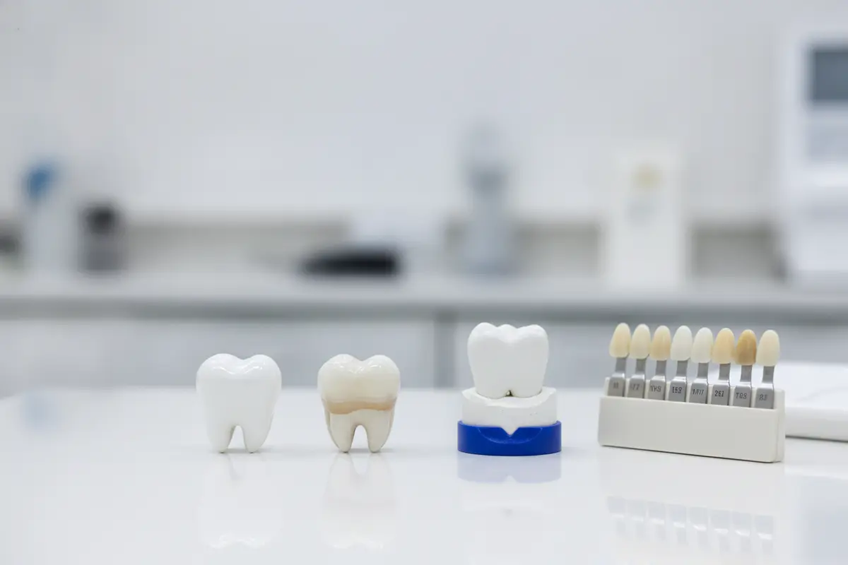 Monolithic and layered zirconia crowns beside a tooth model and shade tabs