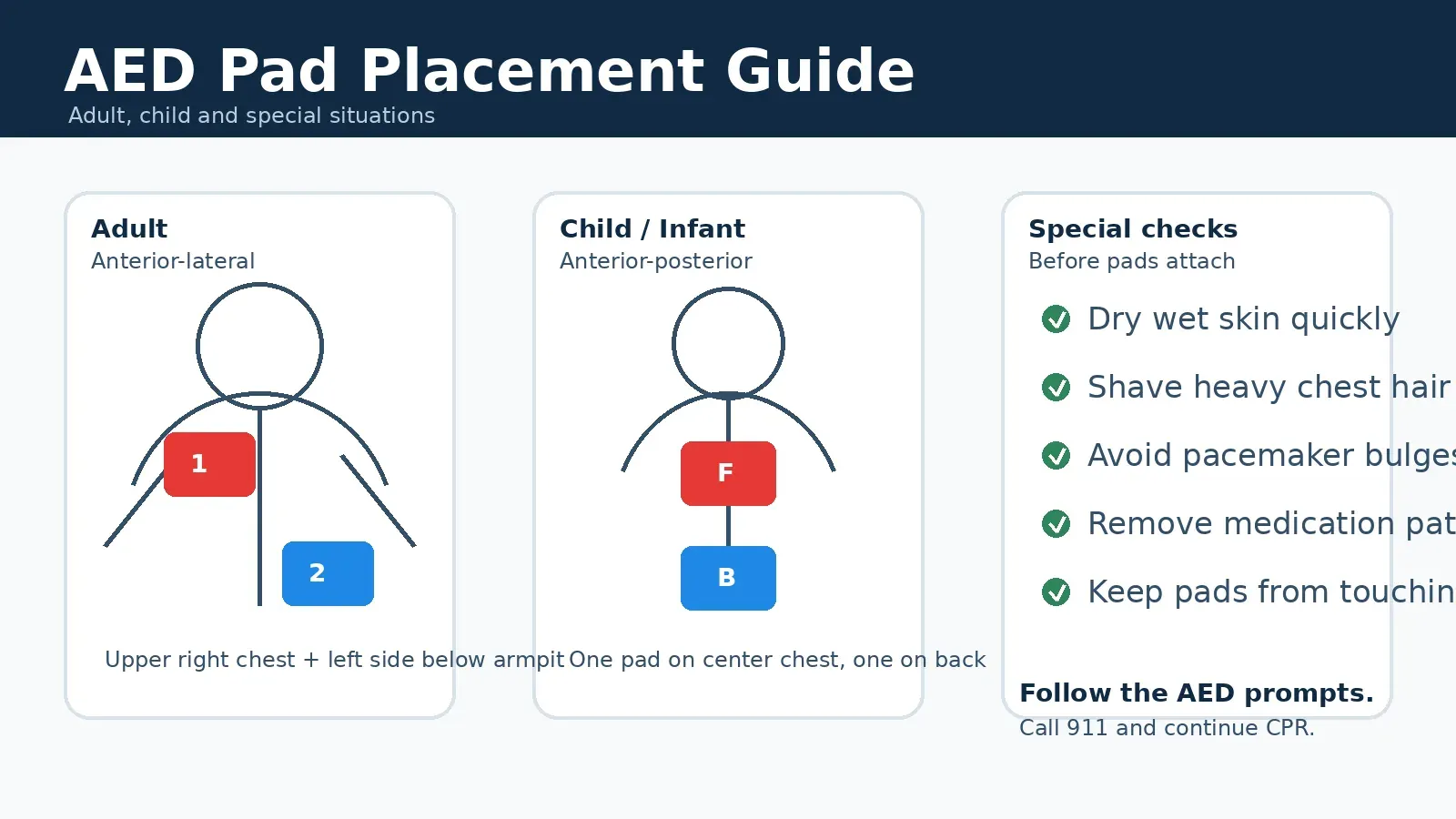 AED pad placement guide showing adult child and special situation pad positions