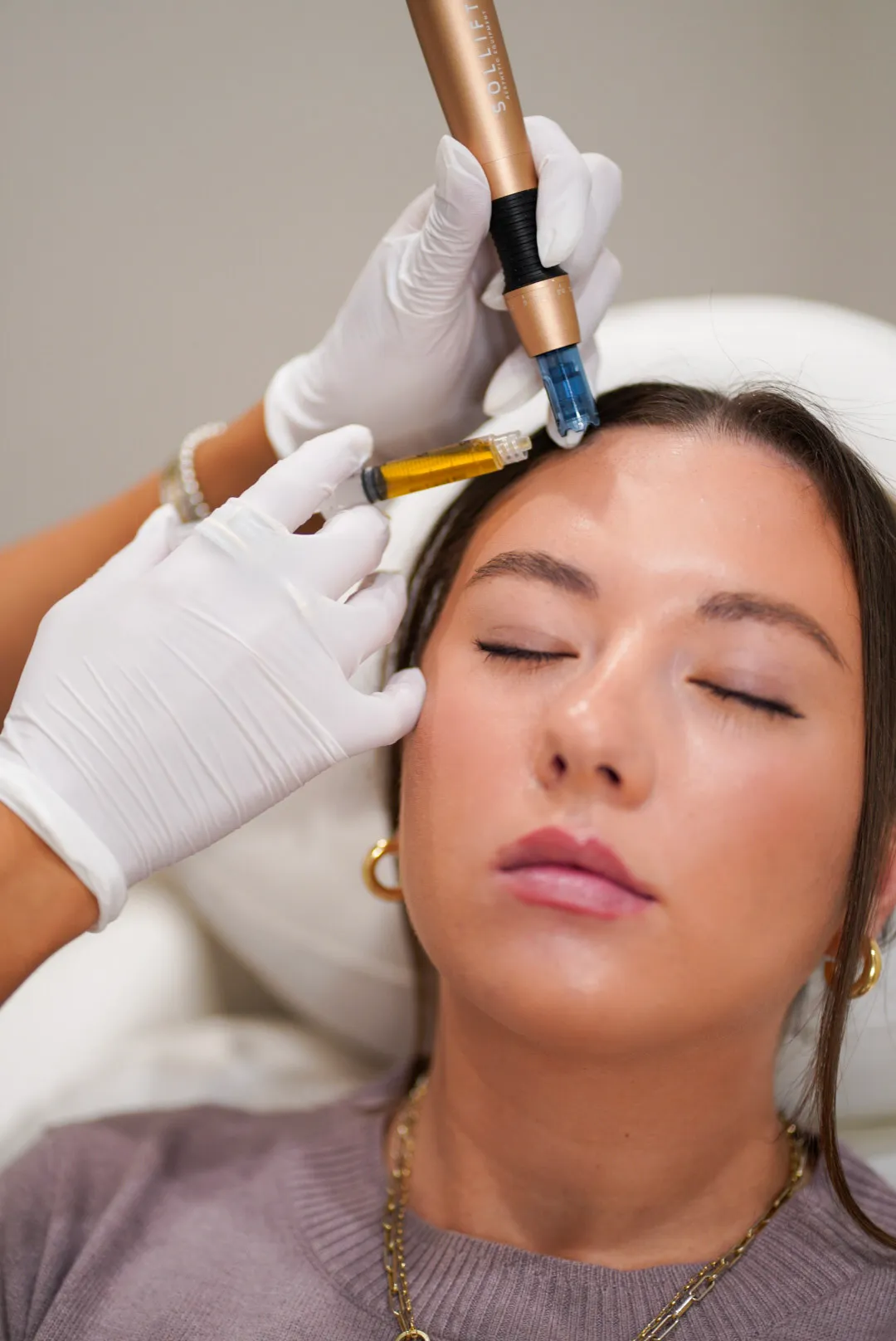 Personalized microneedling with PRP consultation in Orange County
